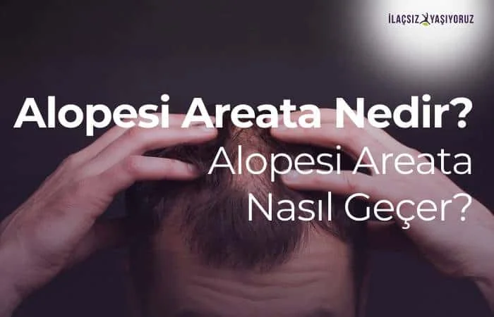 alopesi